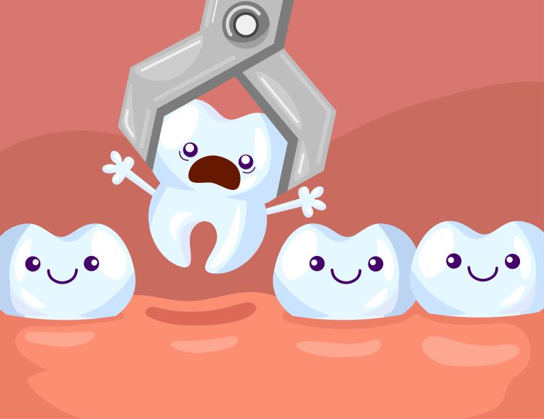 ¿Por qué es necesario reemplazar los dientes perdidos y cerrar los huecos?